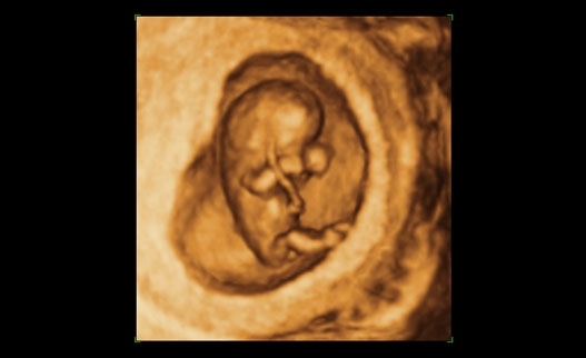 Gravid i 11 uge